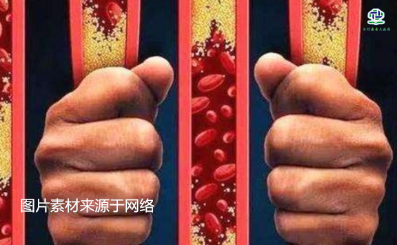 不想給血管&ldquo;添堵&rdquo;，盡量少吃以下這些東西，或許能讓腦梗離遠些  